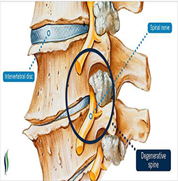 Neurosurgeon in Aurangabad