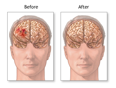 Neurosurgeon in Aurangabad